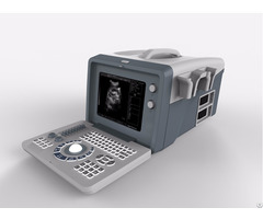 Full Digital Ultrasound B And W Portable Xf218 Crt