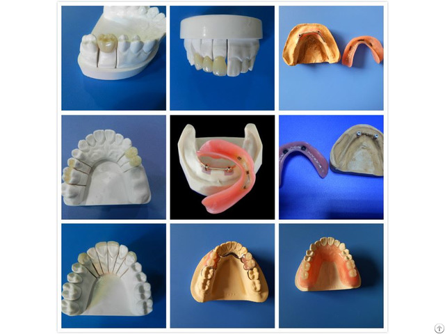 High Quality Dental Lab