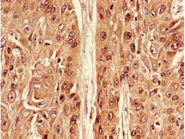 Atg7 Antibody Atg7 Antibody