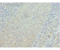 Osbpl2 Antibody