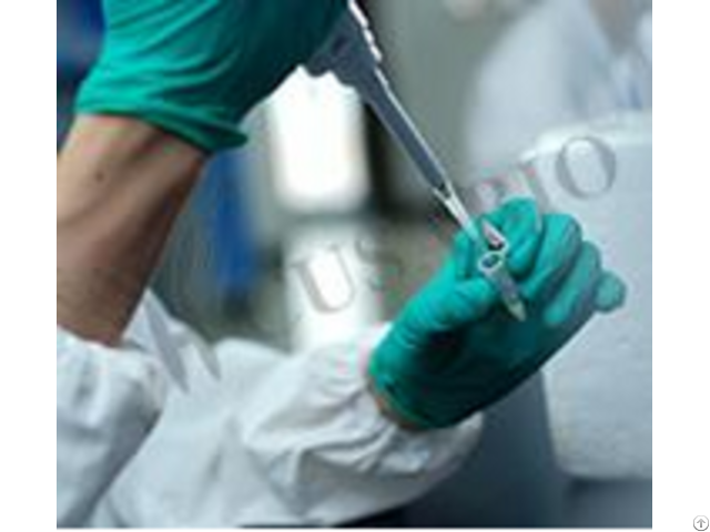 Cmtr2 Antibody Biotin Conjugated Cmtr2 Antibody Biotin Conjugated