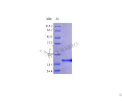 Recombinant Human Interleukin 6 Protein Il6