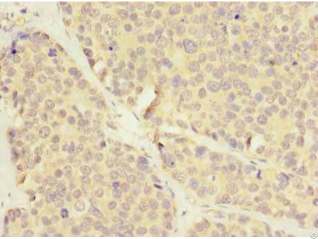 Lrrc8e Antibody