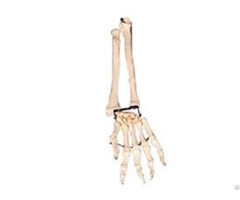 Jy A1013 Palm With Elbow And Radial Bone