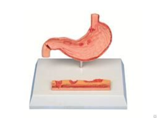 Jy A6080 Disease Stomach