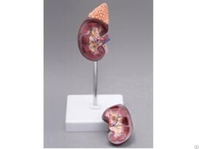 Jy A6097 Kidney Model