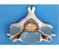 Jy A6052 Fifth Cervical Vertebra With Spinal Cord And Nerve