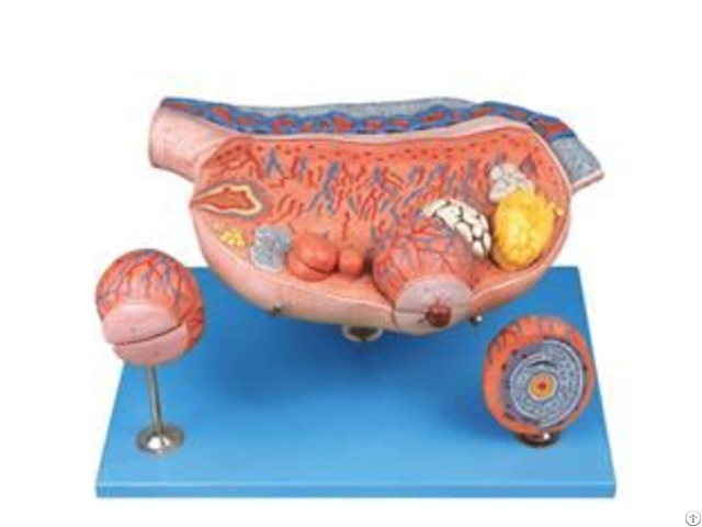 Jy A6130 Enlarged Ovary