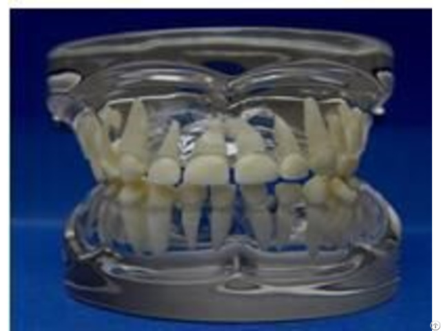 Jy B10012 Transparent Milk Teeth Development Model