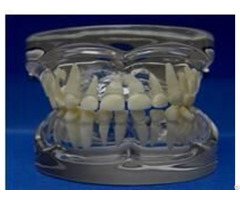 Jy B10012 Transparent Milk Teeth Development Model