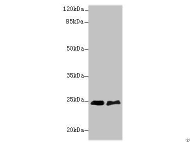 Sertad1 Antibody