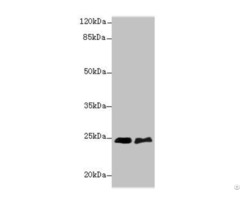 Sertad1 Antibody