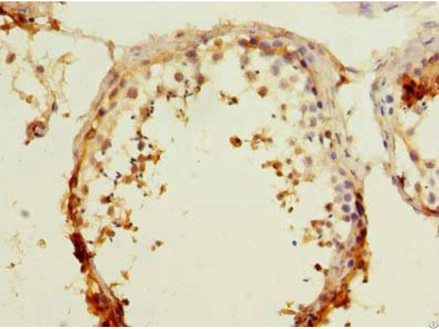 Rapgef5 Antibody