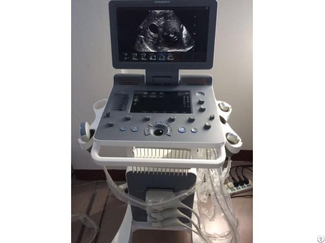 C95 Plus Built In Trolley Color Doppler Ultrasound Scanner With Touch Screen