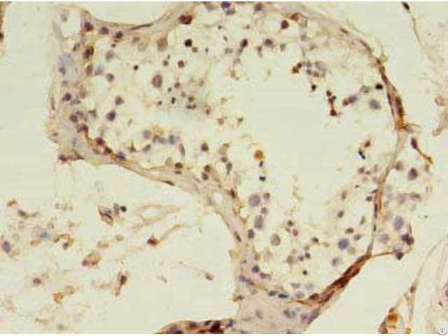 Sart3 Antibody