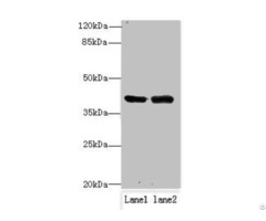 Nif3l1 Antibody