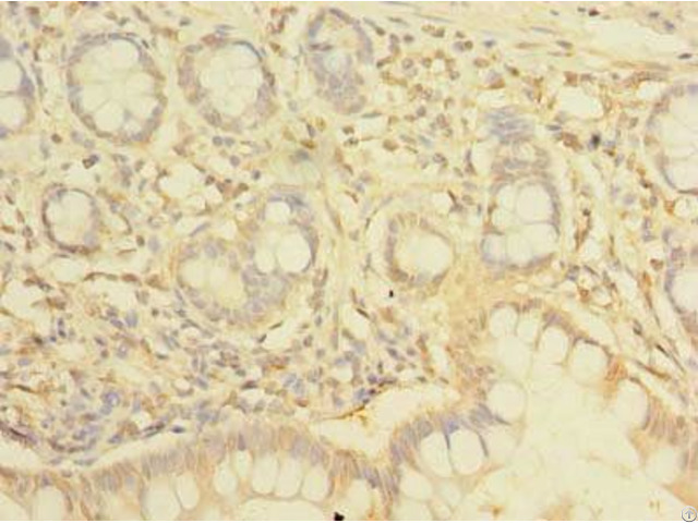 Nhlrc2 Antibody