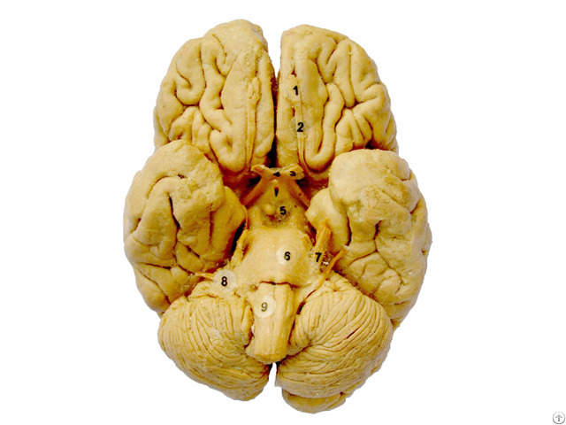 Whole Brain Plastination Specimen