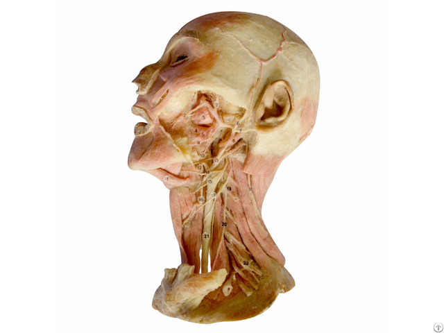 Human Deep Vascular Nerves Of Head And Neck Plastination Specimen