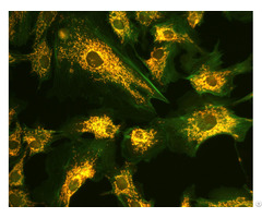 Dual Band Fluorescence Filter Fitc Tritc For Microscope