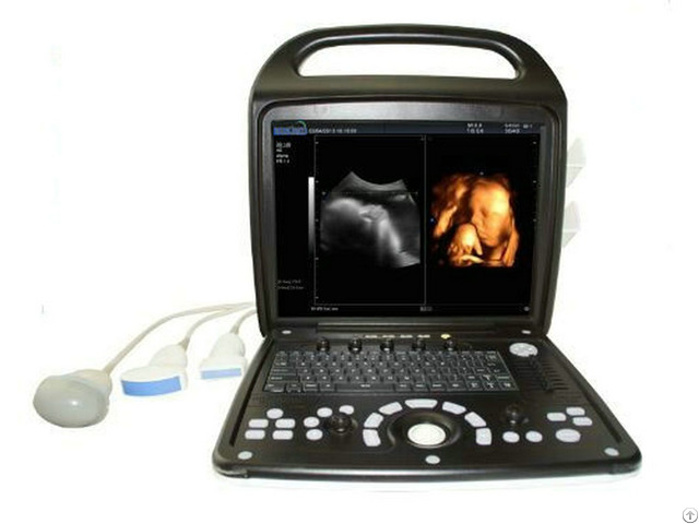 Ultrasound Bene 3v