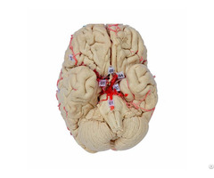 Basilar Artery Of Plastinated Human Brain Specimen