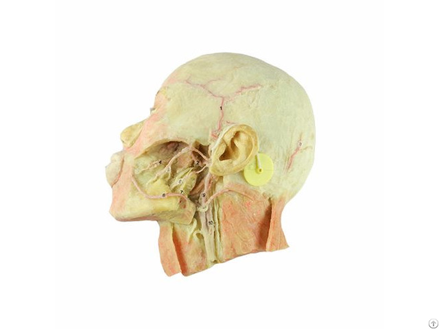 Dissection Of Head And Neck Shows Vertebral Artery Plastinated Specimen