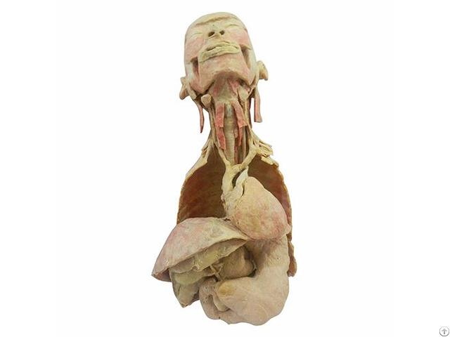 Overview Of Digestive System In Vitro Plastinated Cadavers Medical School
