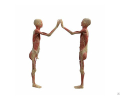 High Five Body Plastinated Specimen