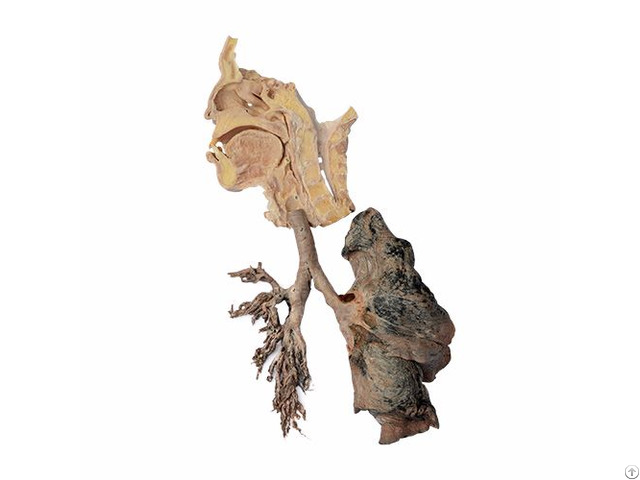 Respiratory System Plastified Human Specimen