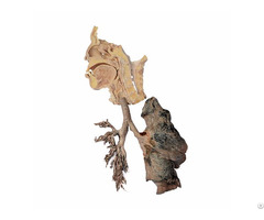 Respiratory System Plastified Human Specimen