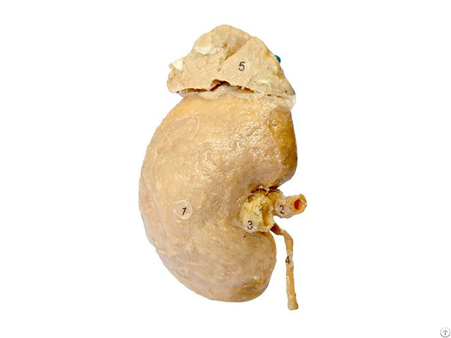 Kidney And Adrenal Gland Plastinated Human Medical Specimens