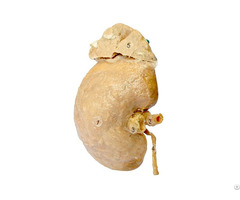 Kidney And Adrenal Gland Plastinated Human Medical Specimens