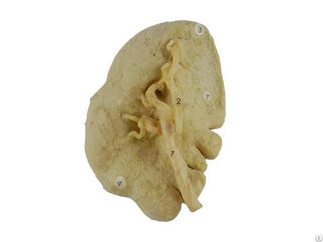 Human Spleen Plastinated Specimen