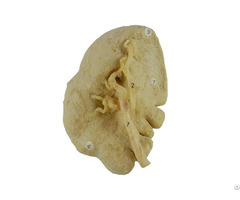 Human Spleen Plastinated Specimen