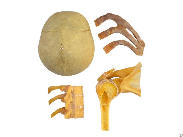 Human Classification Of Bone Union Plastination Specimen