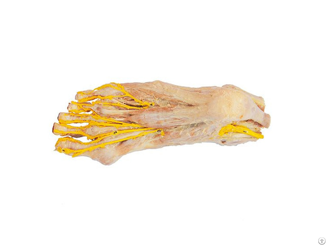 Plantar Nerve Polyester Plastination