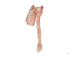 Scapular Region Muscles Plastinated Specimen