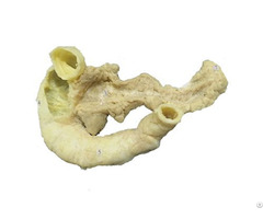 Human Pancreas And Duodenum Plastinated Body Exhibits