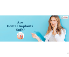 Dental Clinic In Bangalore