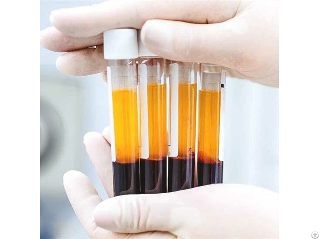 Glass And Pet Pyrogenic Free Prp Kit