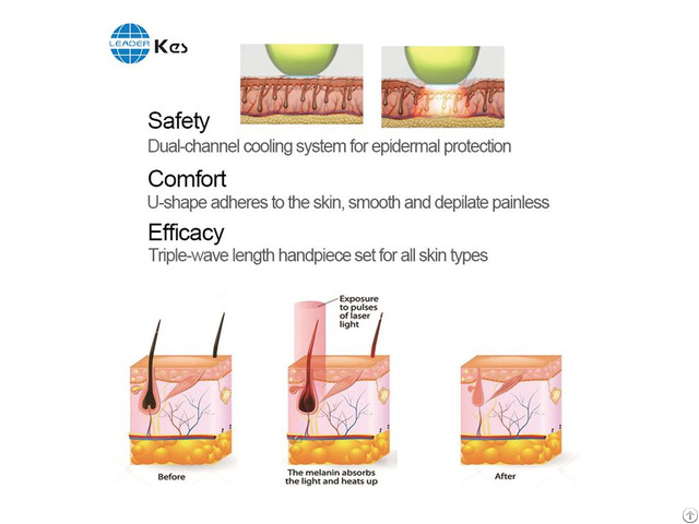 Diode Laser Hair Removal Machine 2