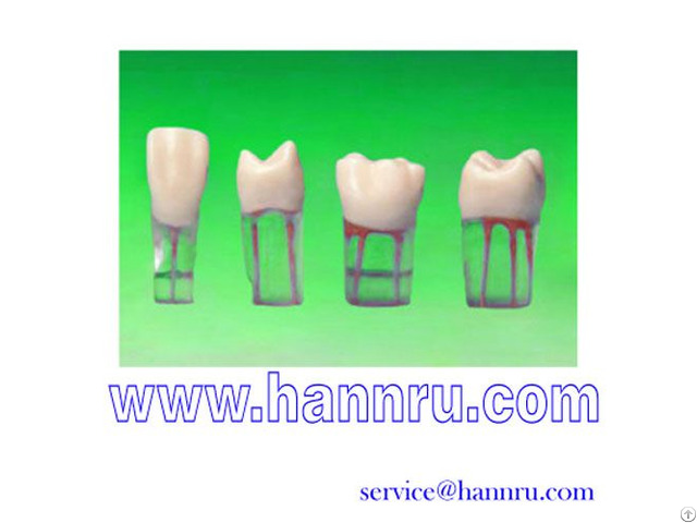 Endodontic Tooth Model