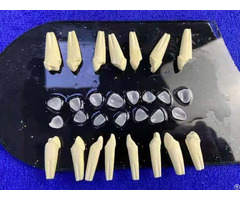 Porcelain Facings Veneer Ivoclar Vivodent