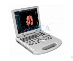 3d 4d 5d Laptop Color Doppler Portable Ultrasound Scanner