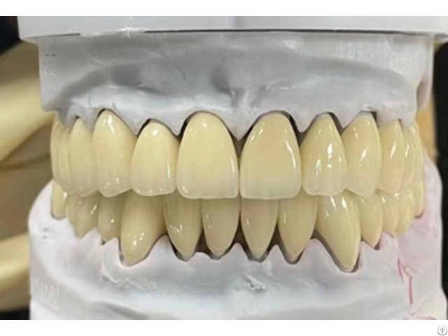 Dental Lab Crown And Bridges