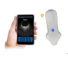 Micro Convex Palm Doppler Ultrasound Scanner