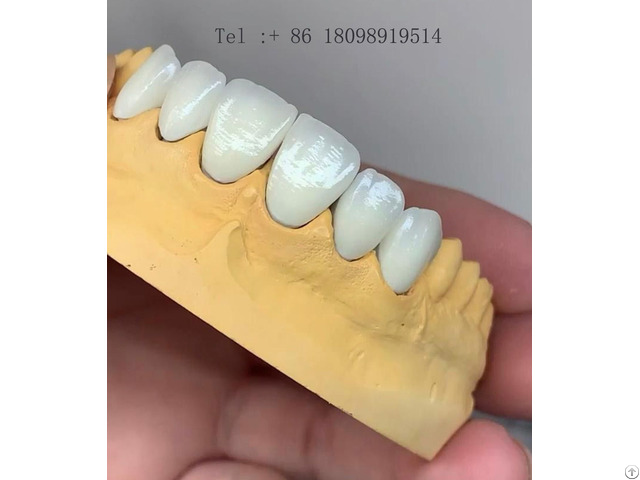 America S Dental Lab