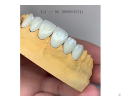 America S Dental Lab