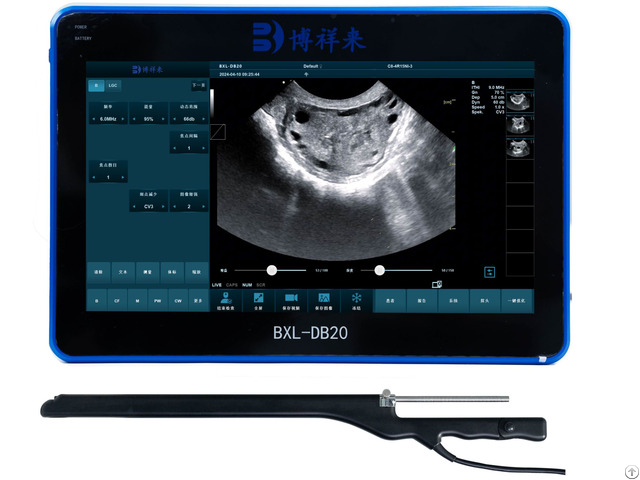 Bxl Db20 Ultrasound Instrument For Veterinary Egg Collection
